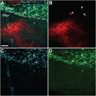 Striatonigral distribution of a fluorescent reporter following intracerebral delivery of genome editors